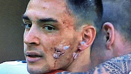 维罗纳遭遇惊天逆转,希望全部破灭 维罗纳遭遇惊天逆转,希望全部破灭